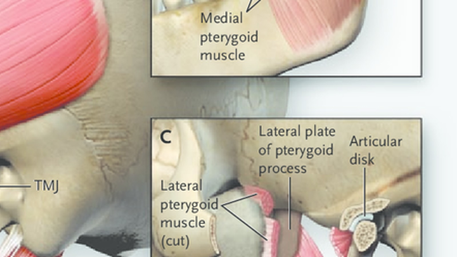 TMJ anatomy illustration